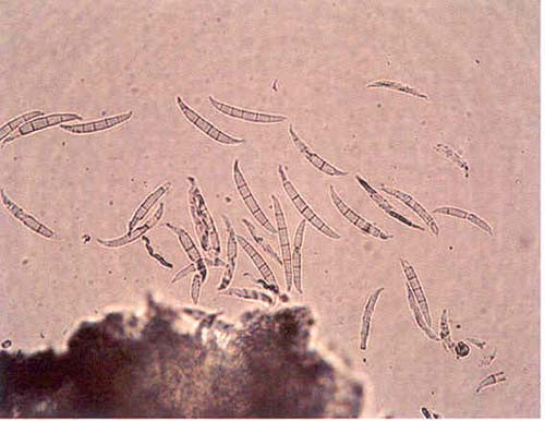 Fusarium graminearum